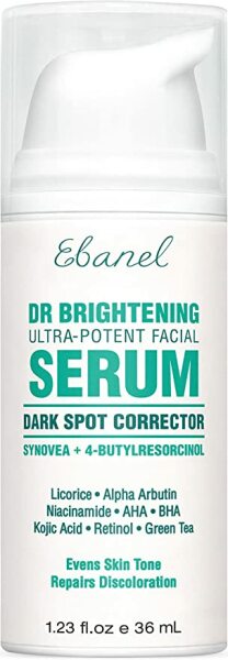 Melasma