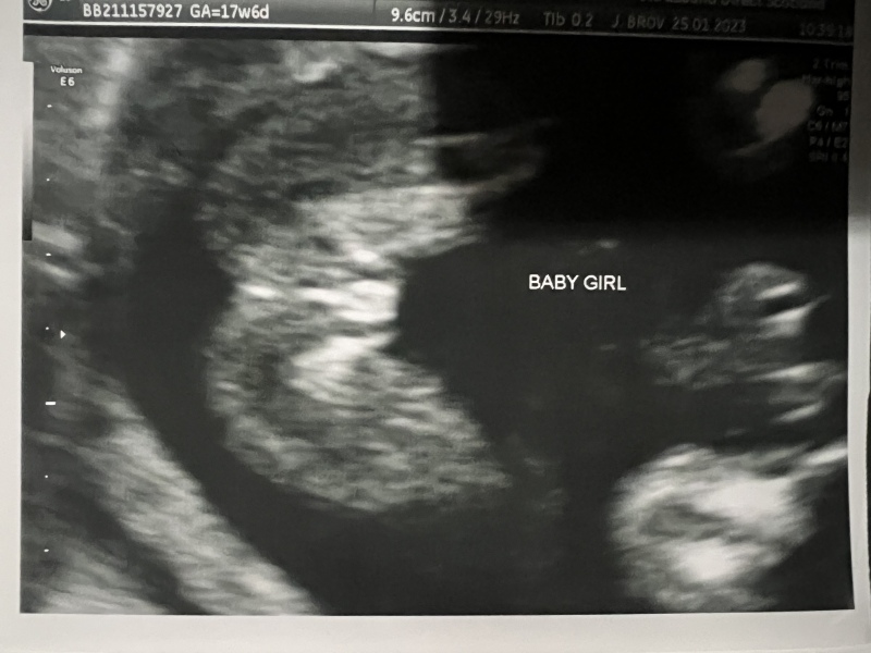 June 2023 Babies ☀️ (thread four)
