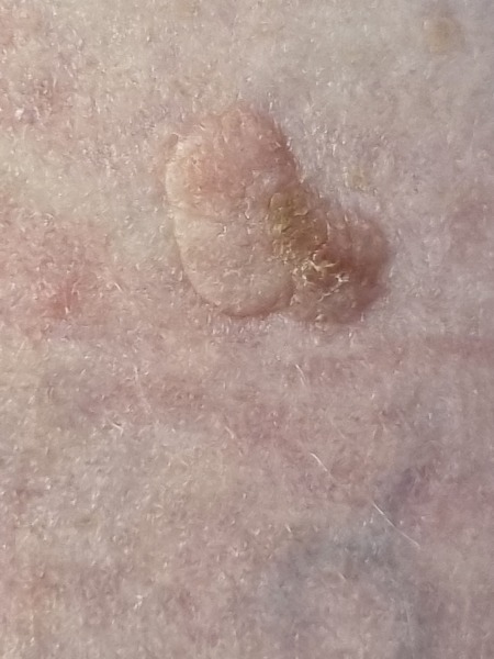 What is this , flat growth thing ( pic )