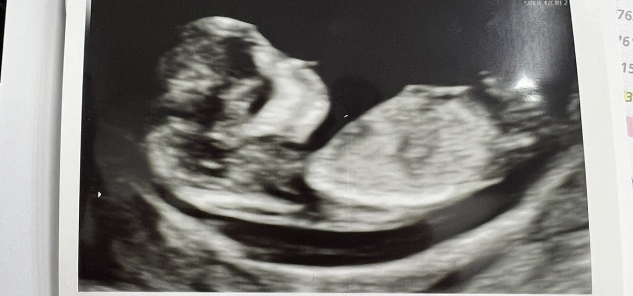 July 2023 (Thread 2)! 