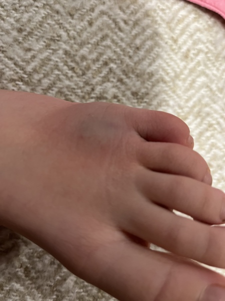 To not take DS to A&E