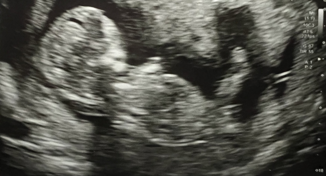 Gender prediction 
