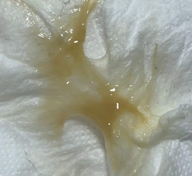 Is this normal? TMI pic attached