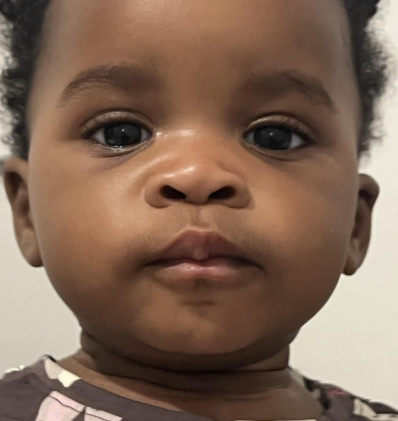 Please be kind. Small Eyes?