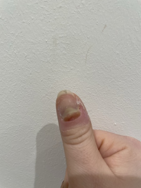 Any dermatologists about?