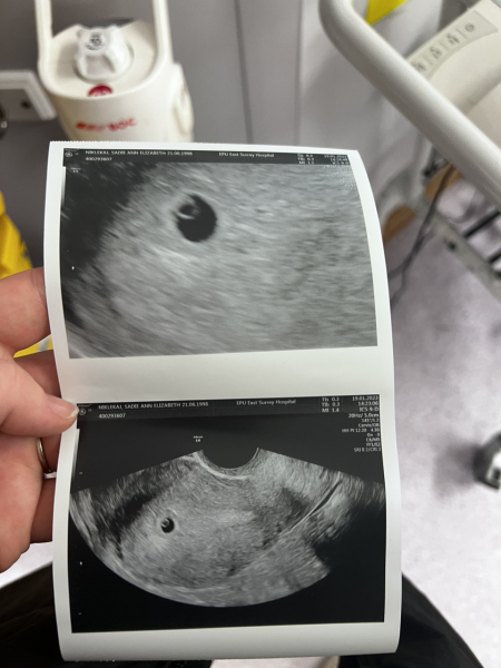 5 weeks today! Sep 23 Thread