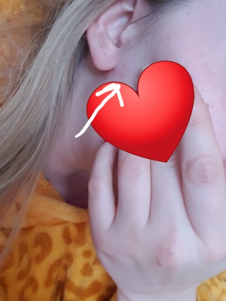 Would an MRI of the jaw show something of concern in this area?