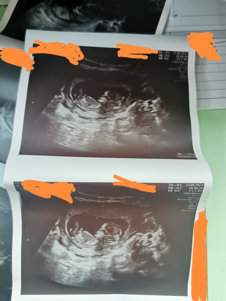 August Due Date Crew (Thread 5)
