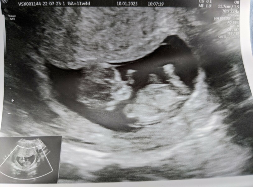 11+4/5 gender guesses?