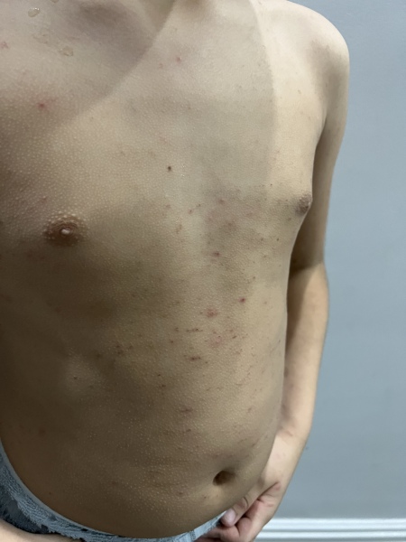 Please tell me what’s going on with my child’s skin (pictures included)