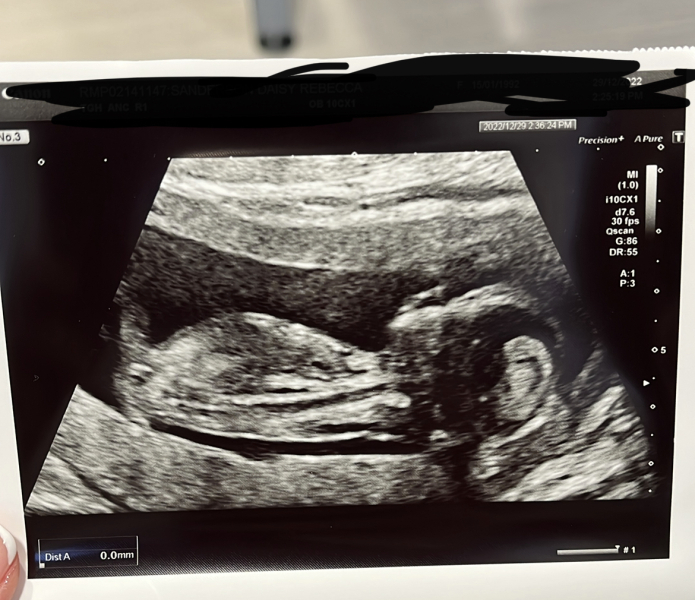 Gender guesses