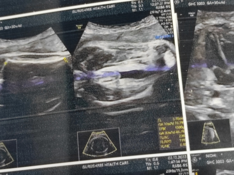 Boy or girl?
