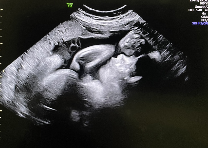 Due March 2023 - Thread 7