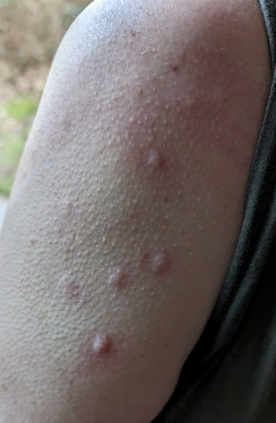 Any idea what this is?  And how to get rid?