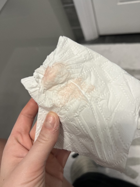 Warning *TMI PIC* Implantation bleeding?