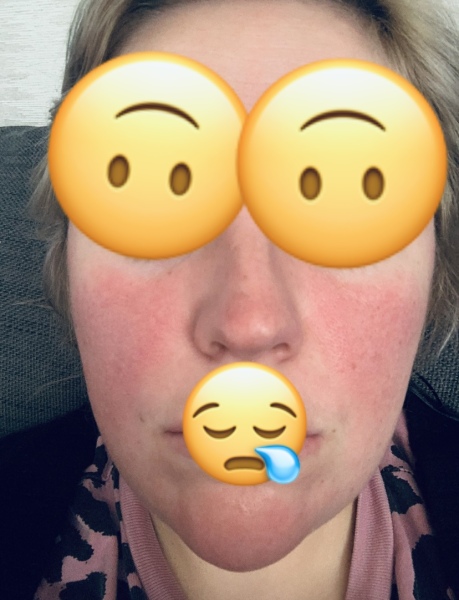 What is wrong with me? Pictures included.
