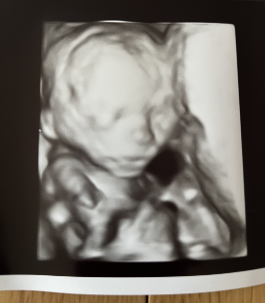 June 2023 Babies ☀️ (Thread 3) 