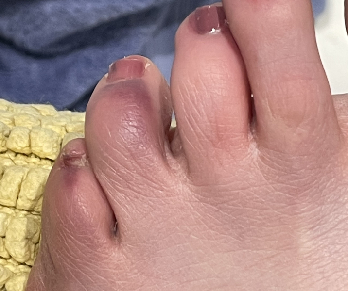 I think I've just broken my toe