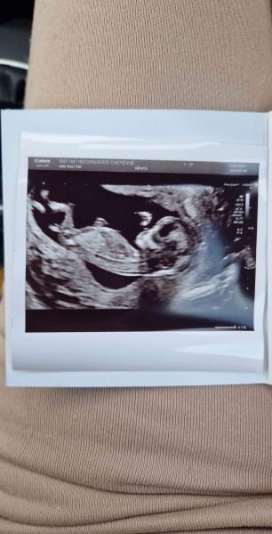 Guess the gender 