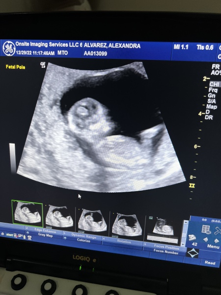 Gender guesses 😊
