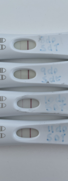First cycle - IVF / ICSI - Day 4 