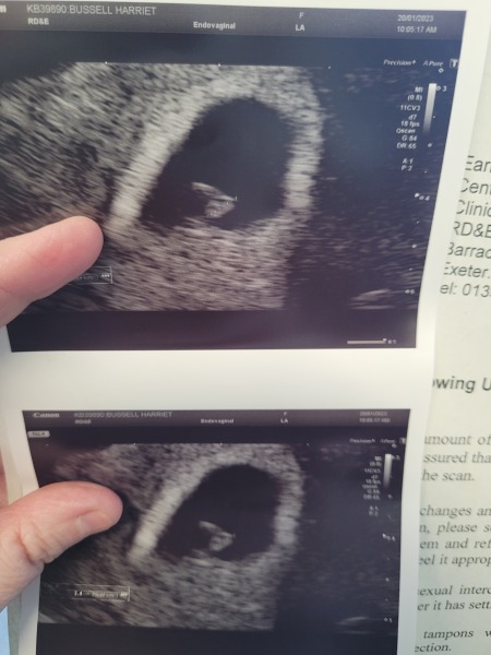 5 weeks today! Sep 23 Thread