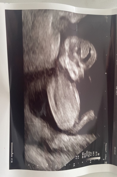 August Due Date Crew (Thread 5)