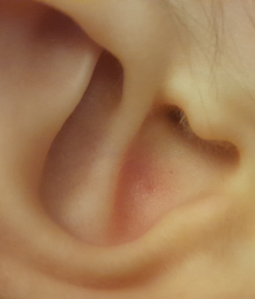 Red mark in ear, what is it?