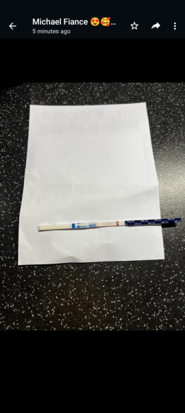 I have had trigger shot yesterday for first time 