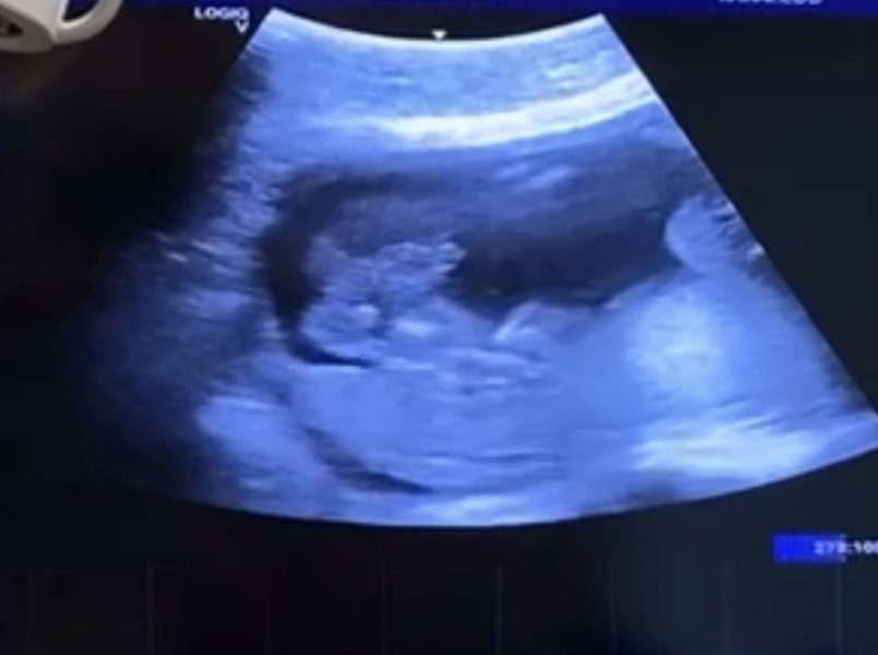Boy or girl guesses