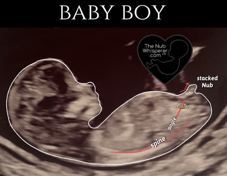 August Due Date Crew (Thread 5)