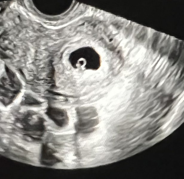 Due September 2023 after miscarriage 🌈