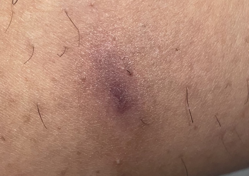 God help me! It’s a crater 