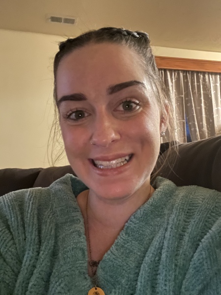 Dimple caused by cheek injury