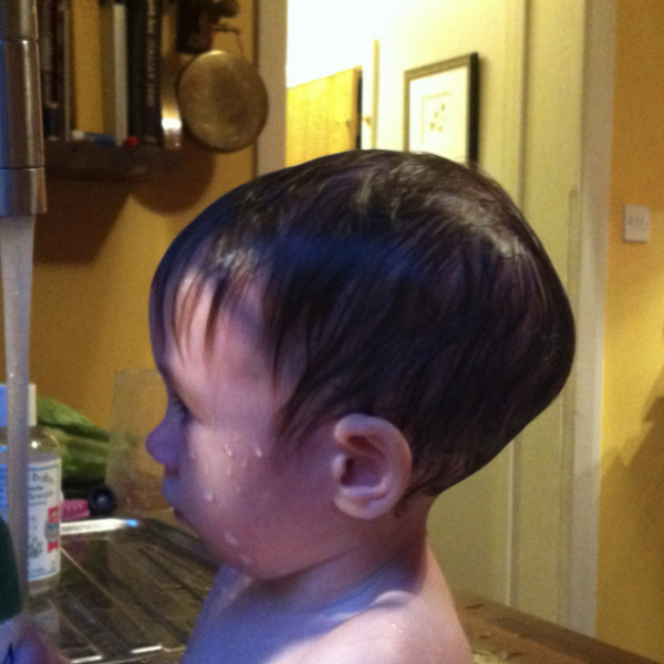 Worried sick. Is this craniosynostosis ?!