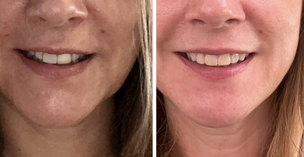 Beauty treatments that have wowed you