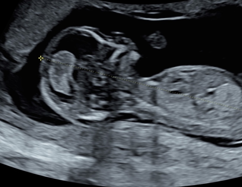August Due Date Crew (Thread 5)