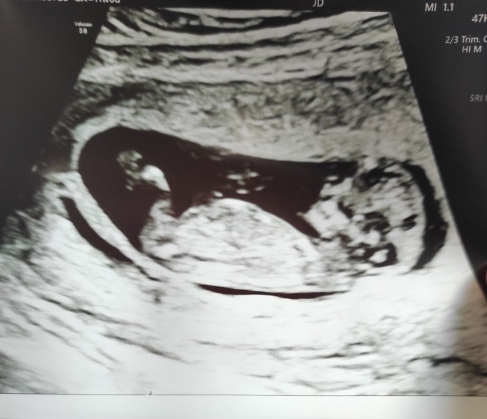 August Due Date Crew (Thread 5)