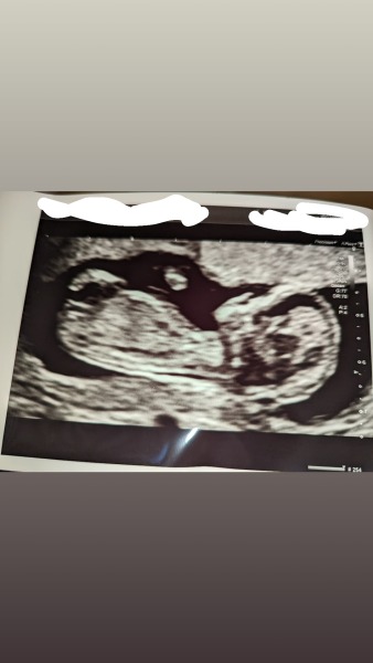 Gender guess!