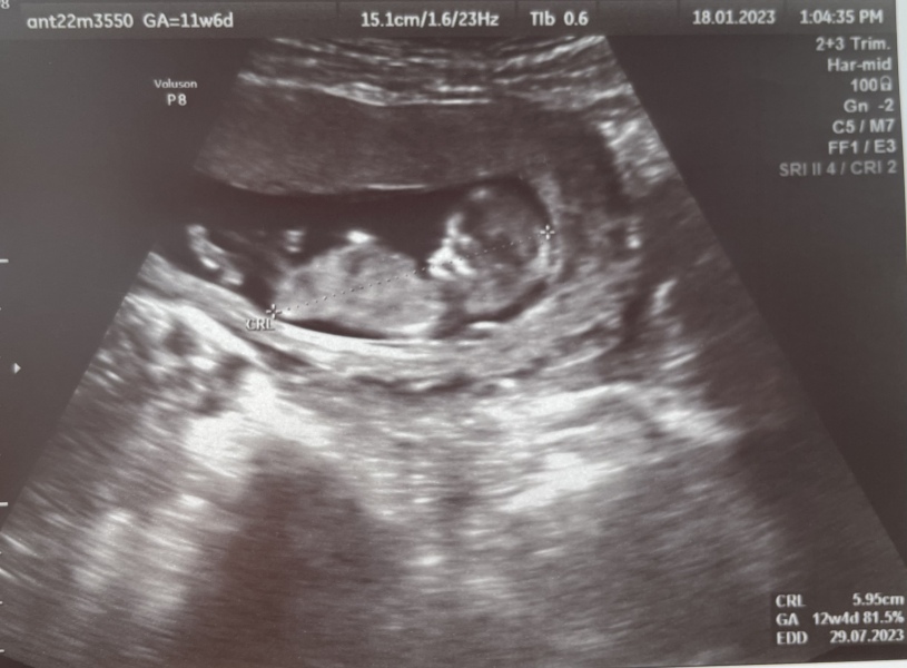 August Due Date Crew (Thread 5)