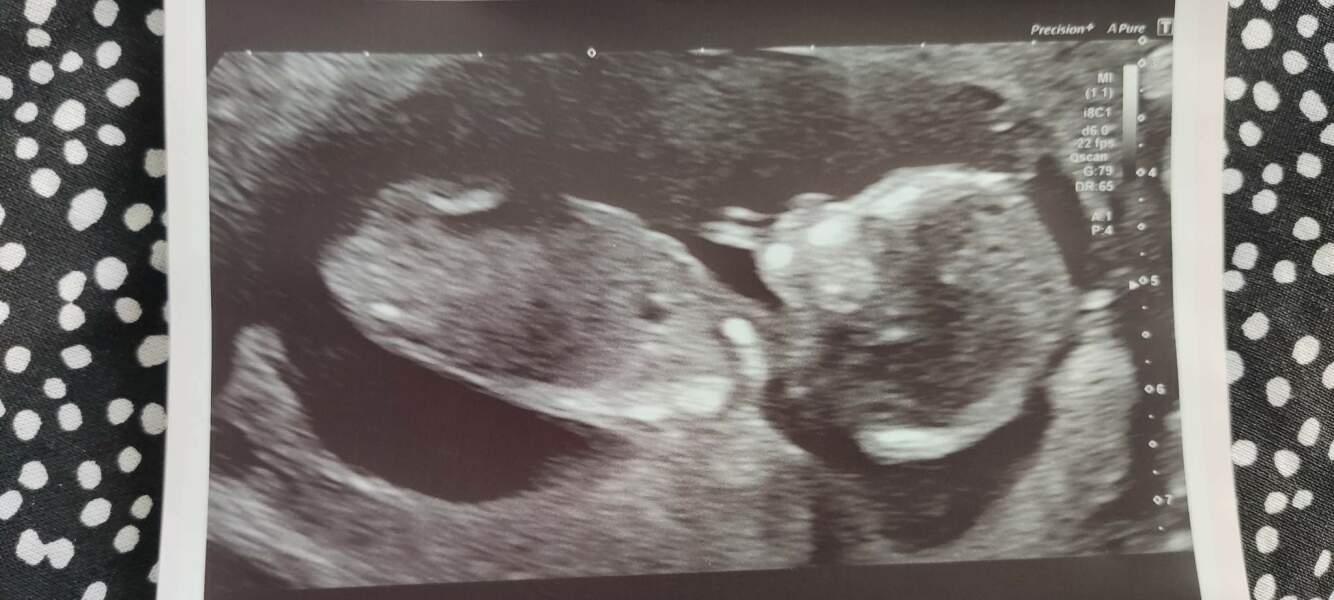 August Due Date Crew - Into Trimester 2 (Thread 6)