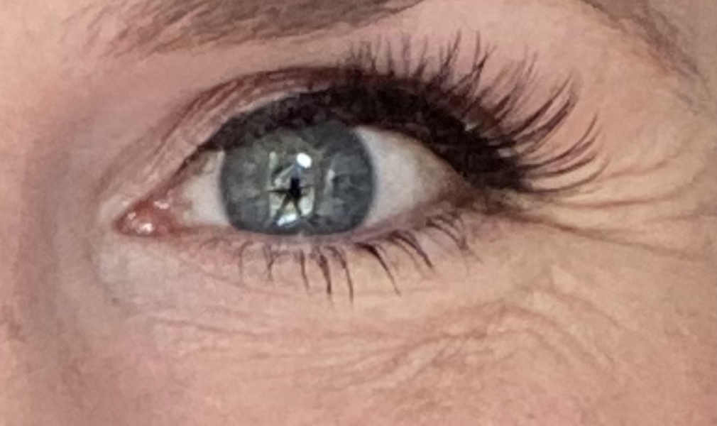 Cancer Support Thread 85 - Hoping for a positive 2023