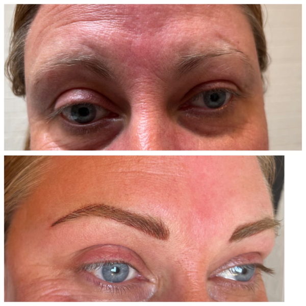 Beauty treatments that have wowed you