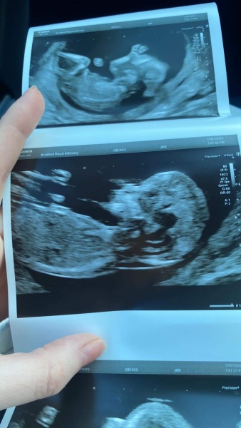 Just for fun do we think baby is a boy or girl