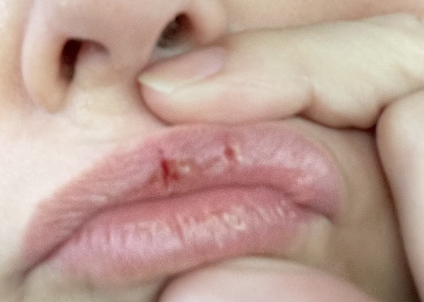 What’s going on with my mouth?
