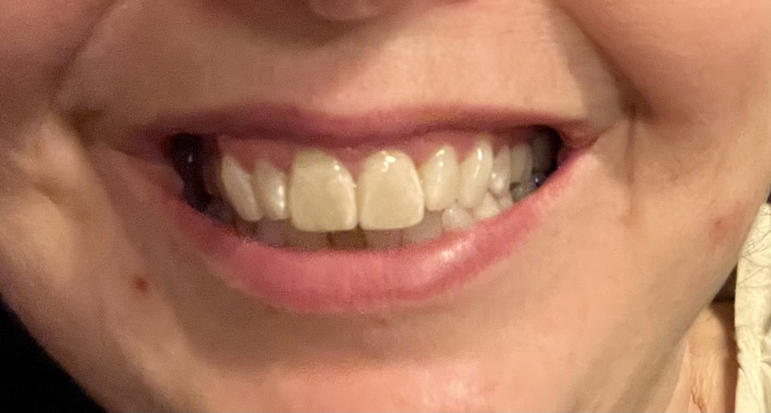 To ask what you think about your teeth and current trends..