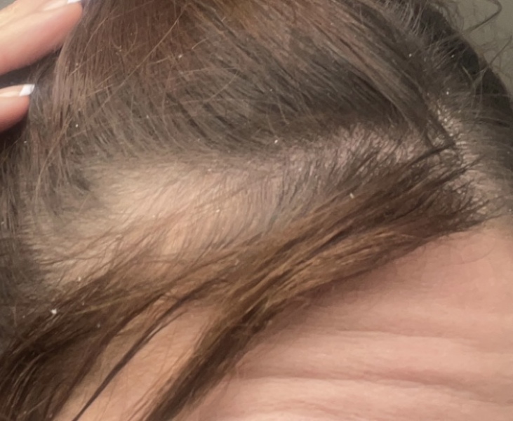To think my hair will never look normal?!