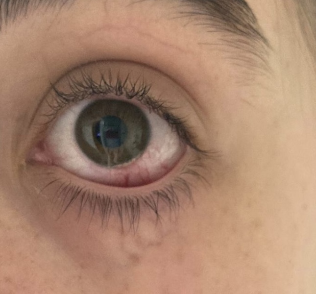 DD15 has an eye.. thing? Advice and ideas please! 