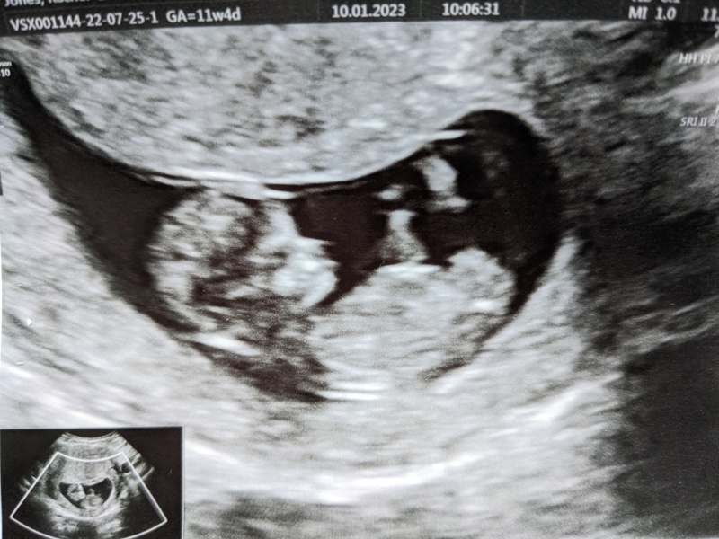 July 2023 (Thread 2)! 