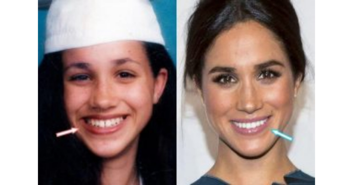 To ask what you think about your teeth and current trends..